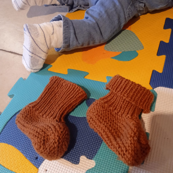 Moldes de botinhas para bebê: adequados para gesso e talas, de 0 a 18 meses